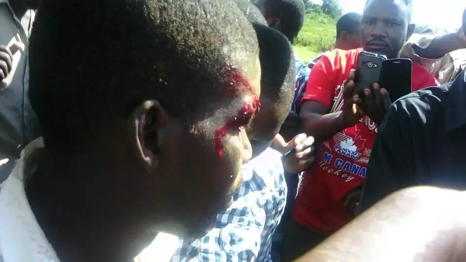 Bungoma Man Falls off from Flying Chopper but escaped death